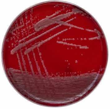thermo-scientific-columbia-blutagar-mit-schafblut